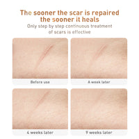 Traditional Medicine Scar Removal Cream