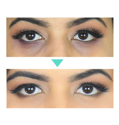"Awaken Radiance and Confidence in Your Eyes"