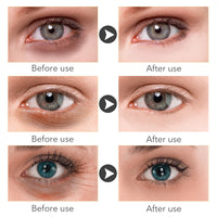 Beauty Eye Cream30ml wish Women's