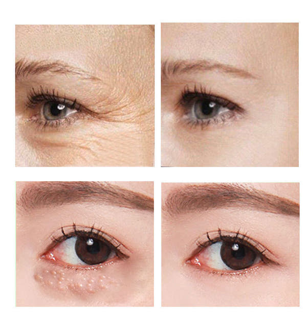 Beauty Eye Cream30ml wish Women's